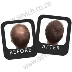 25g Sevich Hair Building Fibres 5 25g Sevich Hair Building Fibres -CROWN SHOP 171217073733 B A Crown 1