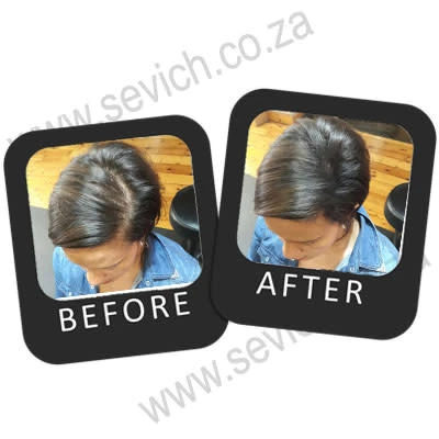 25g Sevich Hair Building Fibres 25g Sevich Hair Building Fibres -CROWN SHOP 171217073733 B A Ellen 1 1