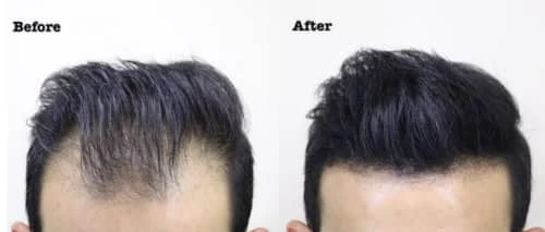 Thick Fiber Hair Building Fibers for Thinning and Fine hair - Medium Brown Thick Fiber Hair Building Fibers For Thinning And Fine Hair - Medium Brown -CROWN SHOP 230308161612 Screenshot202890629 3