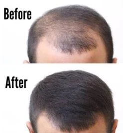 Thick Fiber Hair Building Fibers For Thinning And Fine Hair - Grey 2 Thick Fiber Hair Building Fibers For Thinning And Fine Hair - Grey -CROWN SHOP 230308161612 Screenshot202890729 2