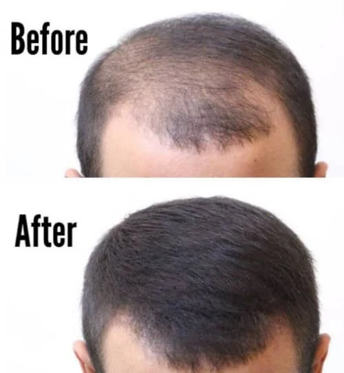 Thick Fiber Hair Building Fibers for Thinning and Fine hair - Medium Brown Thick Fiber Hair Building Fibers For Thinning And Fine Hair - Medium Brown -CROWN SHOP 230308161612 Screenshot202890729 3