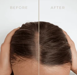 Rosemary Water For Hair Growth 50ml -CROWN SHOP 230606131058 rosemary water hair ba 1675199385070