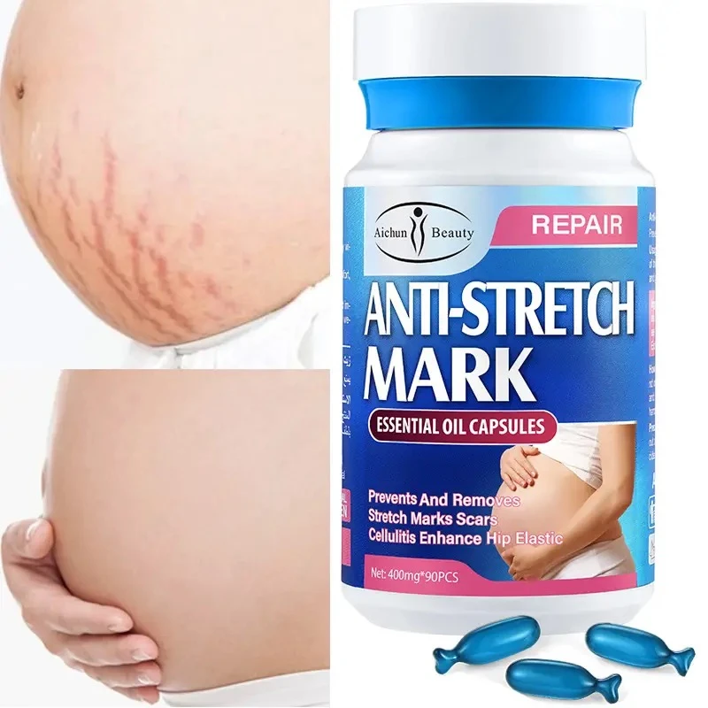 Anti Stretch Mark Essential Oil Capsules Box Of 90 Anti Stretch Mark Essential Oil Capsules Box Of 90 -CROWN SHOP anti stretch mark essential oil capsules 1